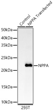 NPPA Rabbit mAb