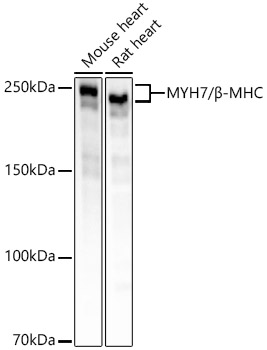 MYH7/β-MHC Rabbit mAb