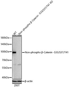 Non-phospho (Active)β-Catenin -S33/S37/T41 Rabbit mAb