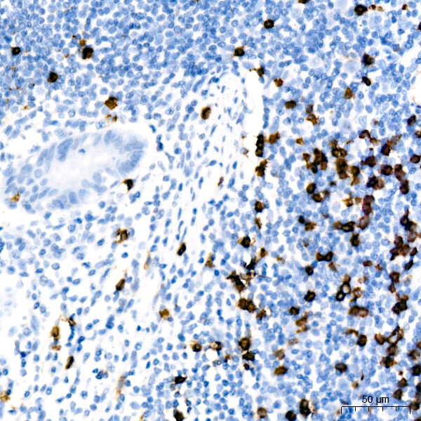 CD8A Rabbit mAb