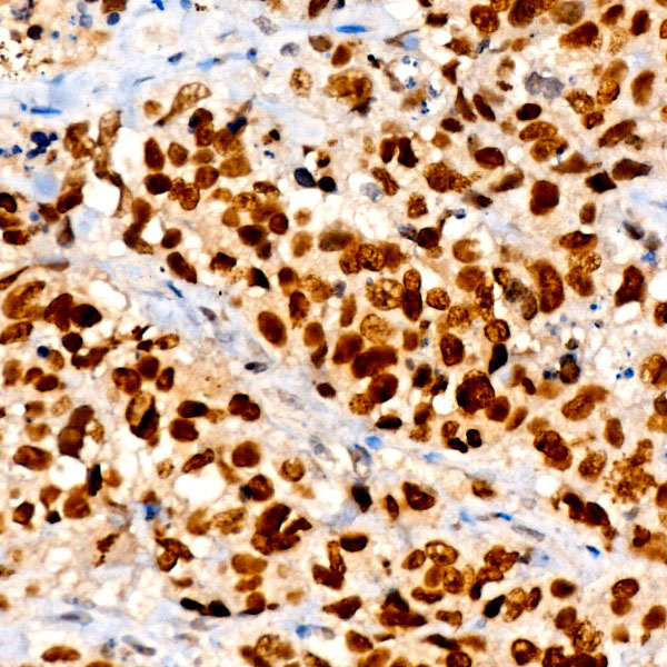 NKX2-1 Rabbit mAb