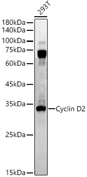 Cyclin D2 Rabbit mAb