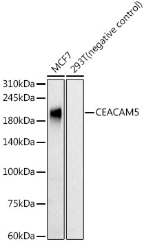 CEACAM5 Rabbit mAb