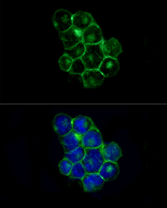 ABflo® 488 Rabbit anti-Human CD225/IFITM1 mAb