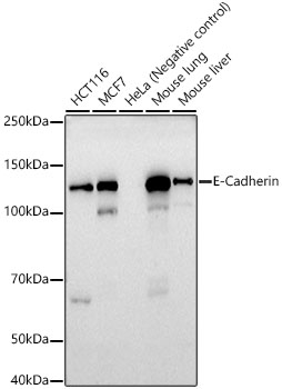 E-Cadherin Rabbit mAb