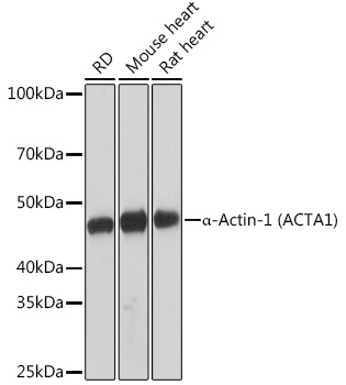 α-Actin-1 (α-SMA) Rabbit mAb