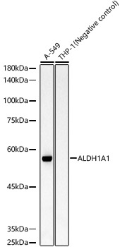 ALDH1A1 Rabbit mAb