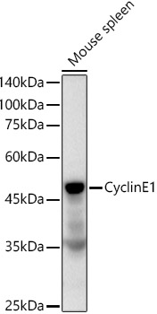 Cyclin E1 Rabbit mAb