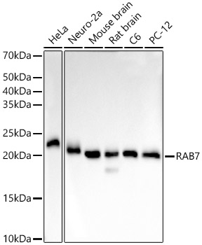 RAB7 Rabbit mAb