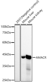 AMACR/p504S Rabbit mAb