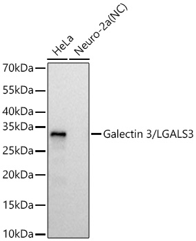 Galectin 3/LGALS3 Rabbit mAb