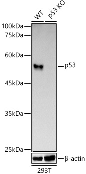 [KO Validated] p53 Rabbit mAb