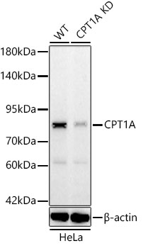 [KD Validated] CPT1A Rabbit mAb