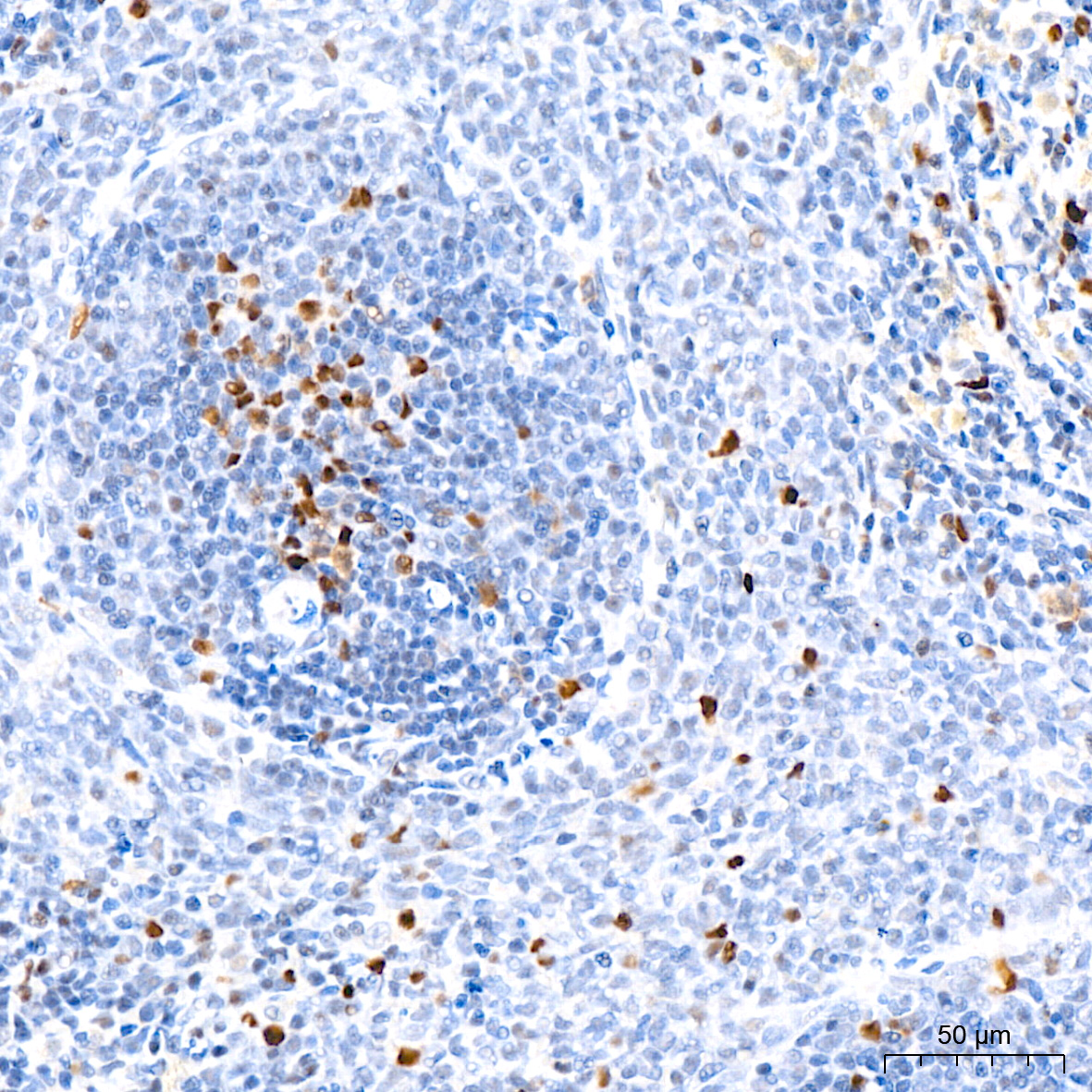 DNMT1 Rabbit mAb