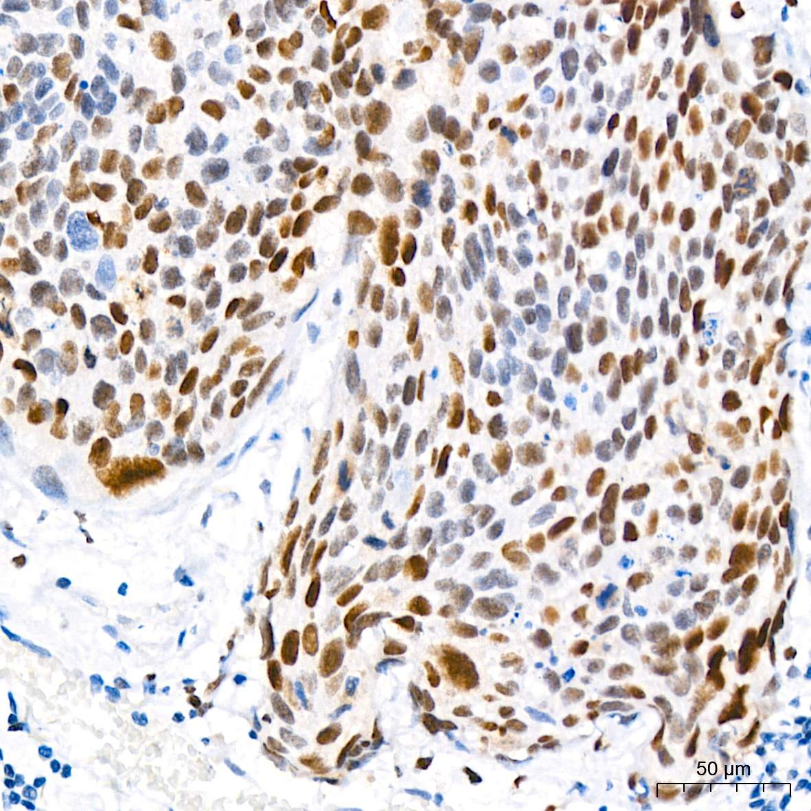 DNMT1 Rabbit mAb