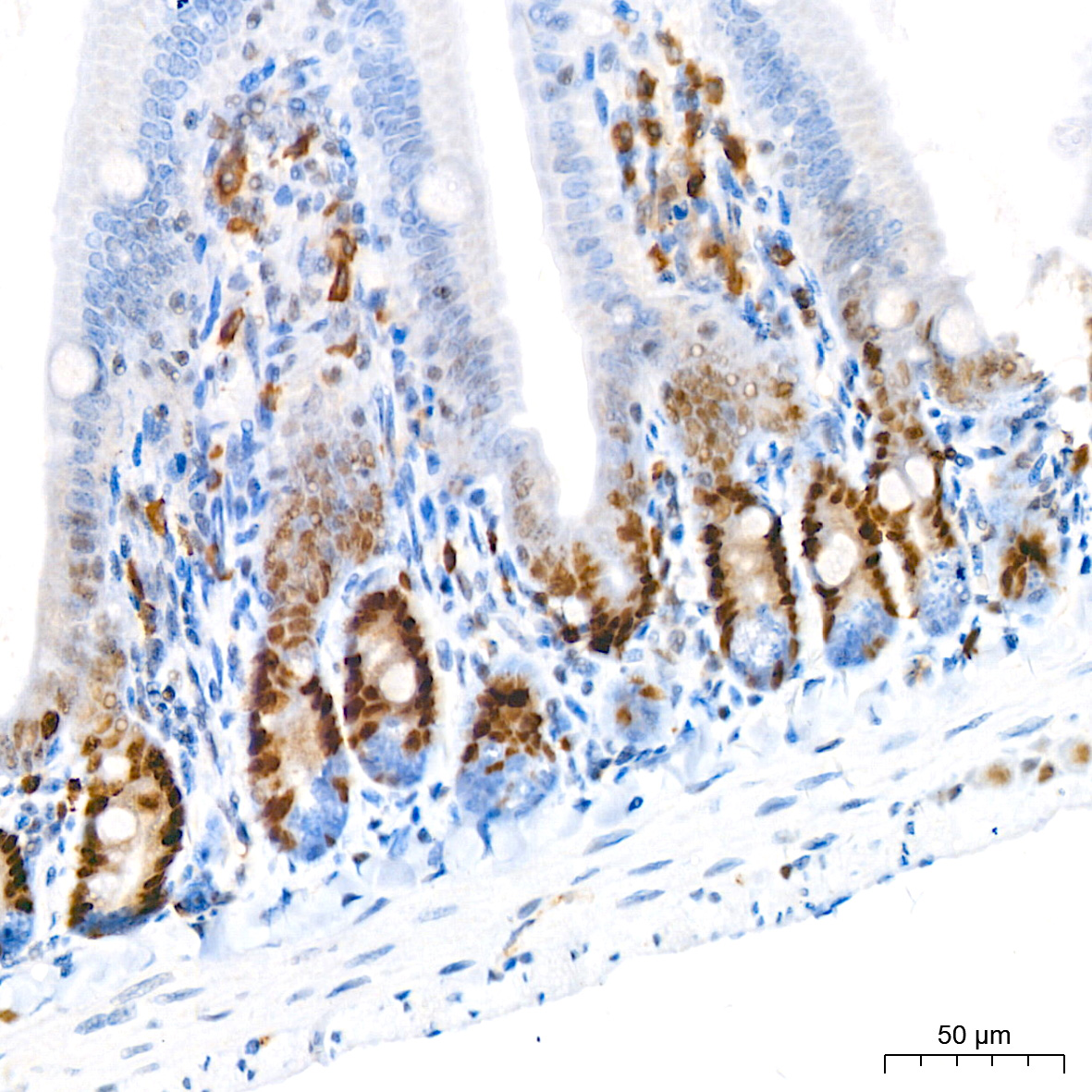 DNMT1 Rabbit mAb