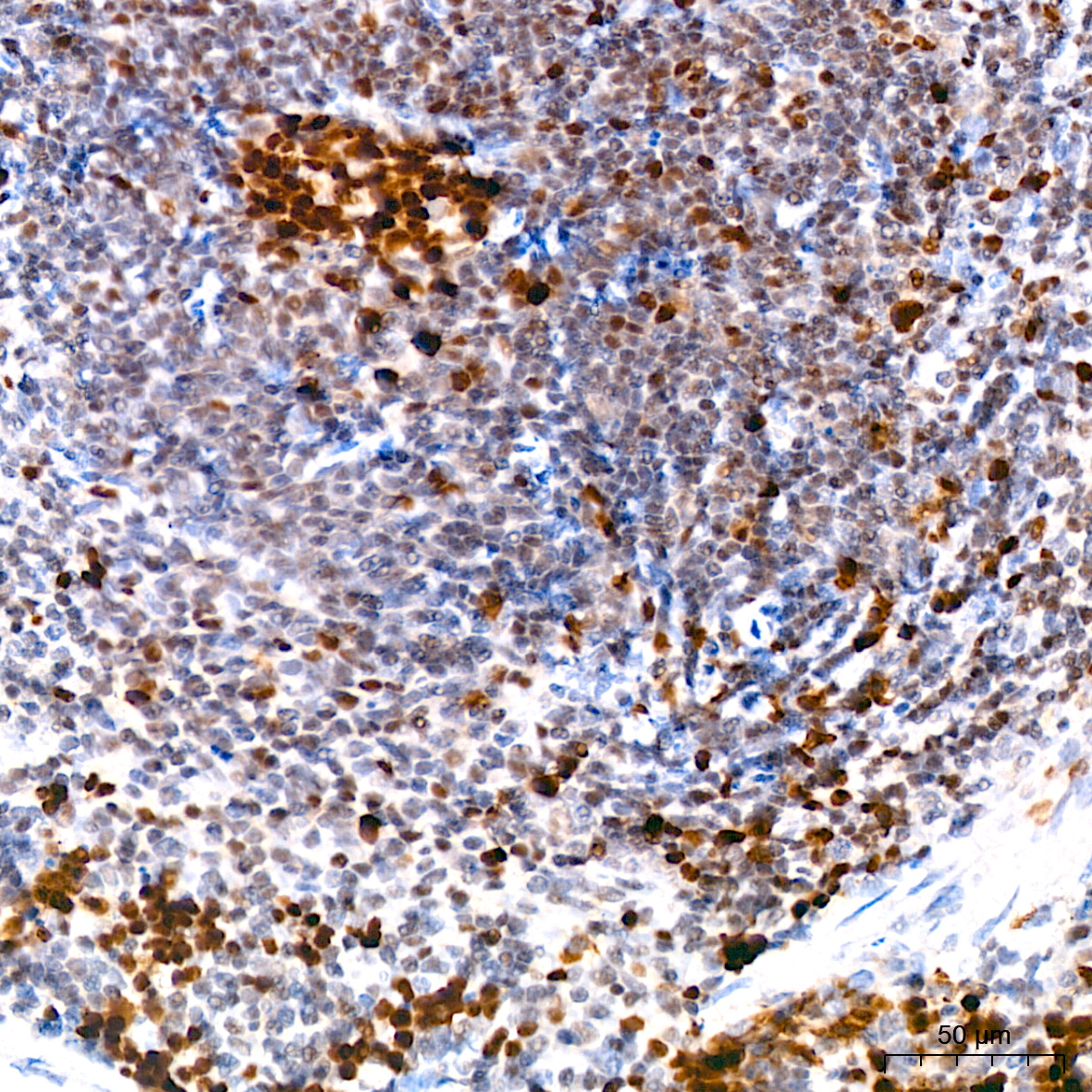 DNMT1 Rabbit mAb