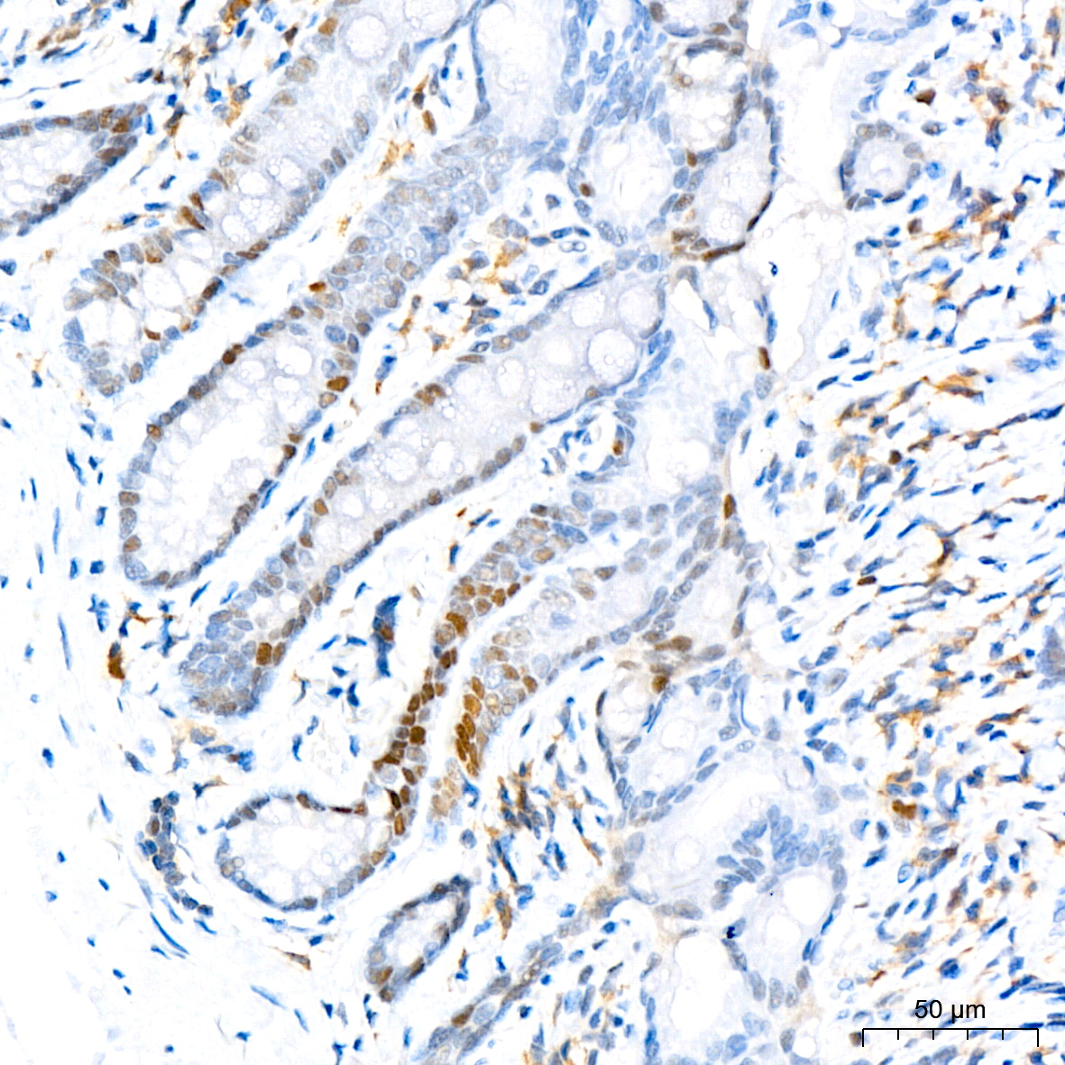 DNMT1 Rabbit mAb