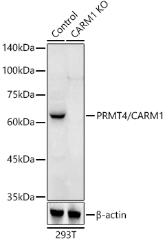 [KO Validated] PRMT4/CARM1 Rabbit pAb