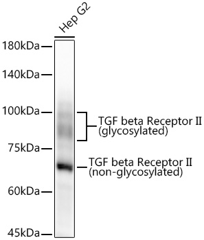 TGF beta Receptor II Rabbit mAb