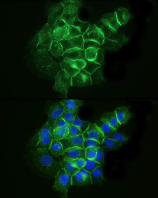 ABflo® 488 Rabbit anti-Human CD142 mAb