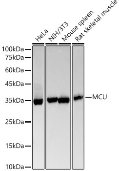 [KO Validated] MCU Rabbit mAb