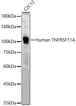 Human TNFRSF11A Rabbit pAb