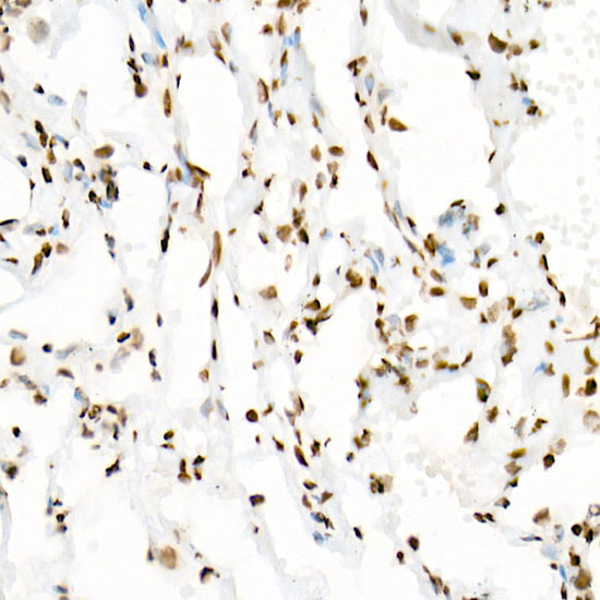 Acetyl-Histone H3-K18 Rabbit mAb