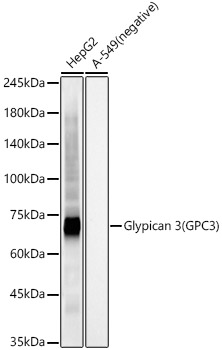 Glypican 3 (GPC3) Rabbit mAb