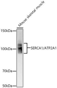 SERCA1/ATP2A1 Rabbit mAb