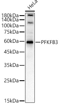 PFKFB3 Rabbit PolymAb®