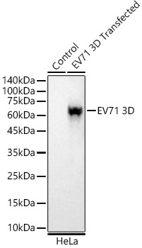 EV71 3D Rabbit mAb-Monoclonal Antibodies - ABclonal/拜爾國際(BioAb)