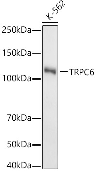 TRPC6 Rabbit mAb