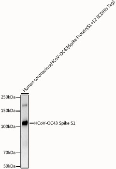 HCoV-OC43 Spike S1 Rabbit mAb