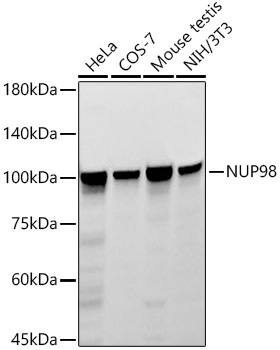 NUP98 Rabbit mAb