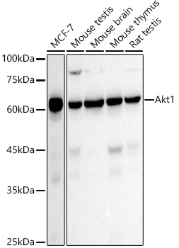 [KO Validated] AKT1 Rabbit mAb