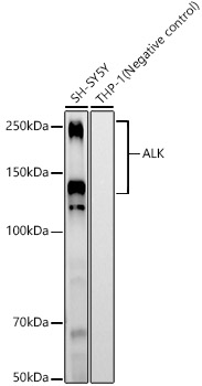 ALK Rabbit mAb