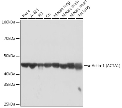 α-Actin-1 (ACTA1) Rabbit mAb