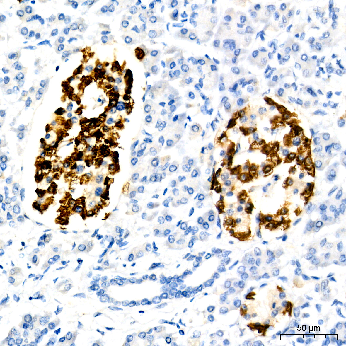 Glucagon Rabbit mAb