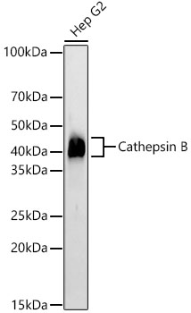 Cathepsin B Rabbit mAb