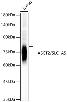 ASCT2/SLC1A5 Rabbit mAb