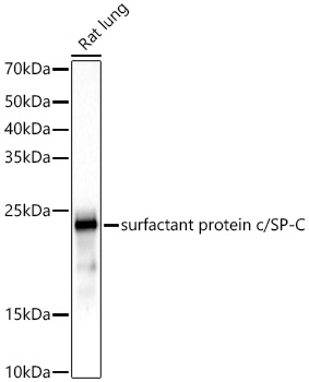 SFTPC Rabbit mAb