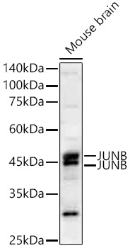 JUNB Rabbit mAb