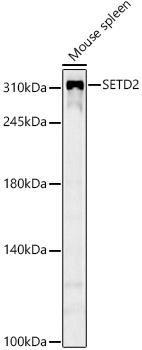 SETD2 Rabbit mAb