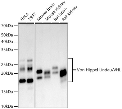 Von Hippel Lindau/VHL Rabbit mAb