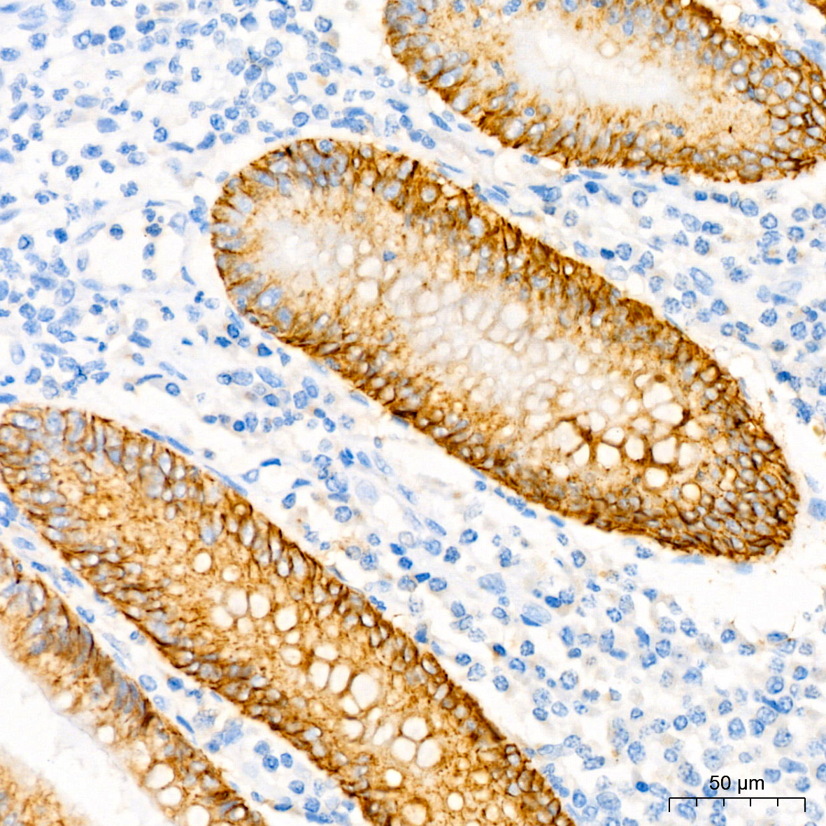 CD138/Syndecan-1 Rabbit mAb