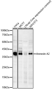 Annexin A2 Rabbit mAb