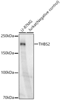 THBS2 Rabbit mAb