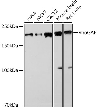 RhoGAP Rabbit mAb