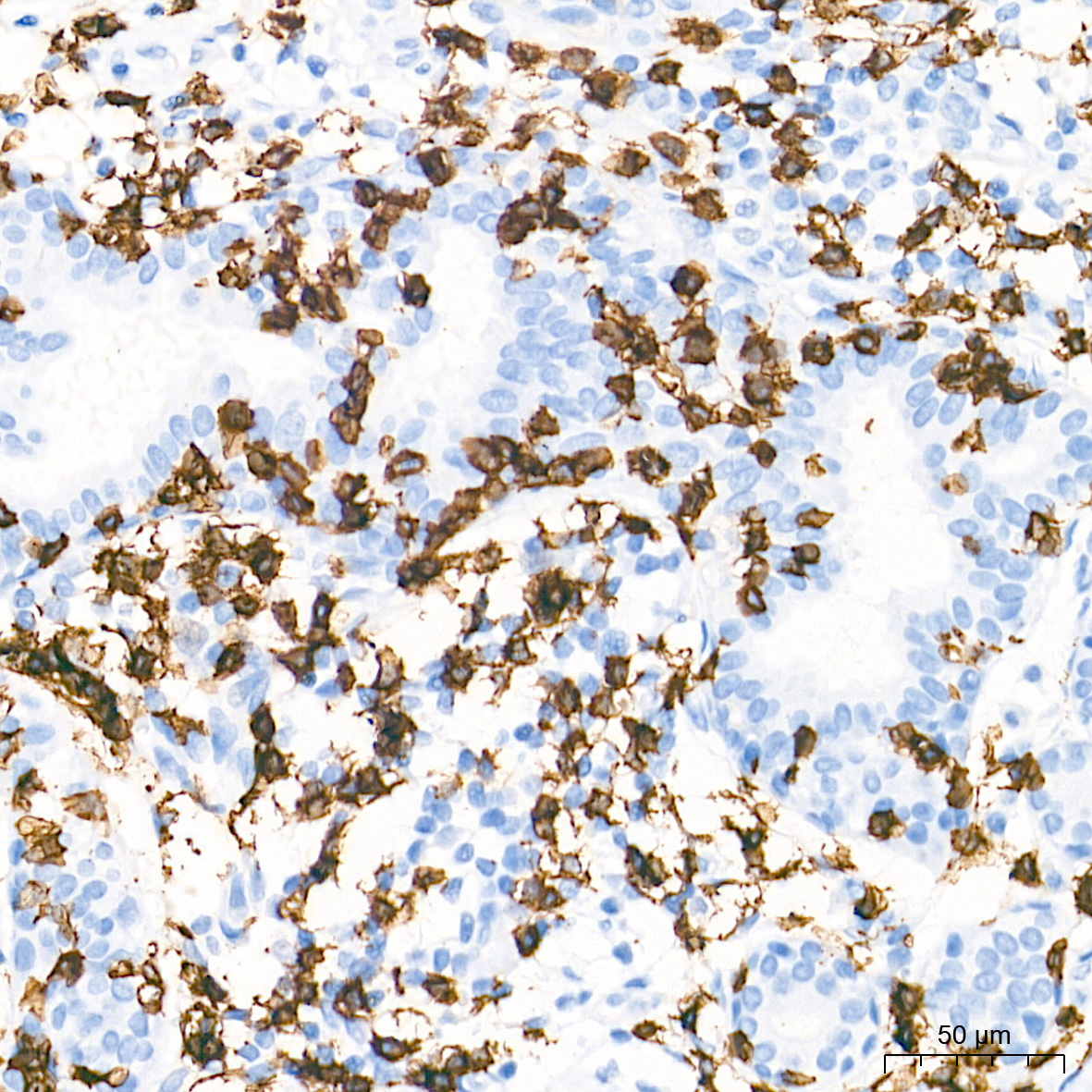 CD8A Rabbit PolymAb®